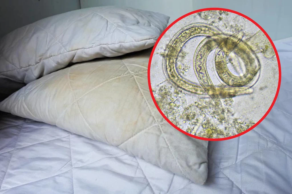 Brudna pościel może być przyczyną przedłużających się chorób zakaźnych np. owsicy