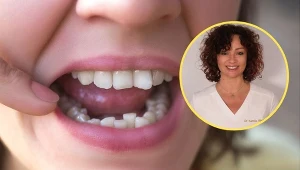 Mama Ortodonta - lek. stom. Kamila Wasiluk - przestrzega, by nie prostować zębów na własną rękę. Może to niszczyć zęby, wywoływać bóle głowy i bezsenność /fot. mat. prasowe