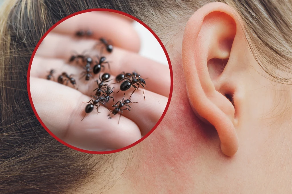 Uważaj na mrówki w domu. Mogą być niebezpieczne dla zdrowia, zwłaszcza jeśli dostaną się do ucha Uważaj na mrówki w domu. Mogą być niebezpieczne dla zdrowia, zwłaszcza jeśli dostaną się do ucha