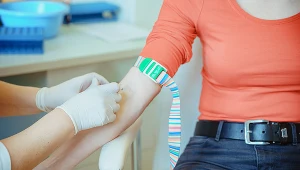 Na liście badań zalecanych przed dietą znajduje się m.in. morfologia czy badanie poziomu TSH