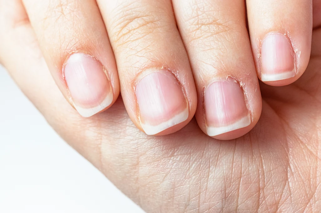 Co zrobić żeby mieć ładne skórki przy paznokciach? Domowe sposoby