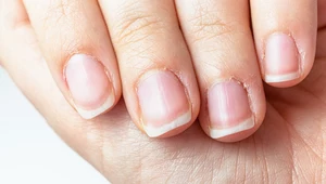 Domowe sposoby na suche skórki przy paznokciach. Uporczywy problem odejdzie w niepamięć