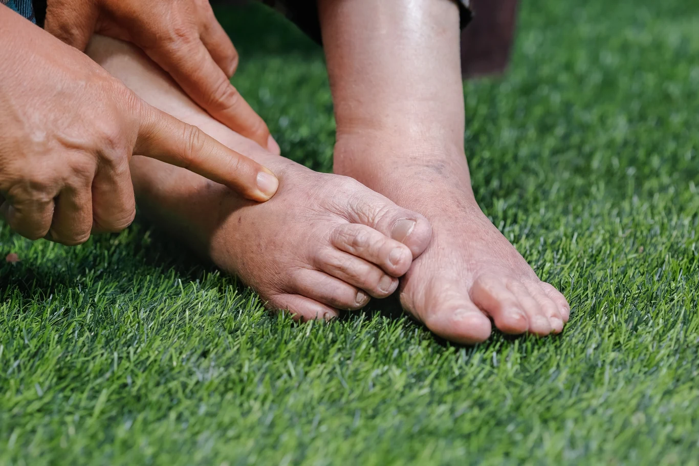 Okłady z octu pomogą pozbyć się opuchlizny z kończyń 