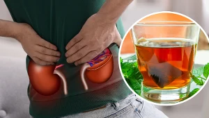 Liść pokrzywy jest stosowany u pacjentów z zaburzeniem oddawania moczu, w stanach zapalnych dróg moczowych czy w piasku nerkowym