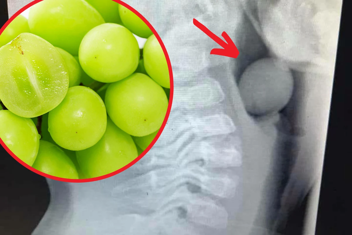 Winogrono może utknąć w drogach oddechowych, tym samym prowadząc do zatrzymania oddechu i śmierci /Facebook/Finleeandme Winogrono może utknąć w drogach oddechowych, tym samym prowadząc do zatrzymania oddechu i śmierci /Facebook/Finleeandme