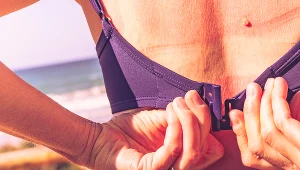 Bardzo duża ekspozycja na szkodliwe promieniowanie UV bez zabezpieczenia się wysokimi filtrami grozi czerniakiem