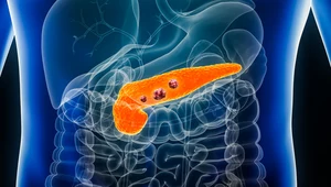 Naukowcy pracują nad szczepionką mRNA, mogącą uratować życie chorym na raka trzustki. Już mają pierwszy sukces