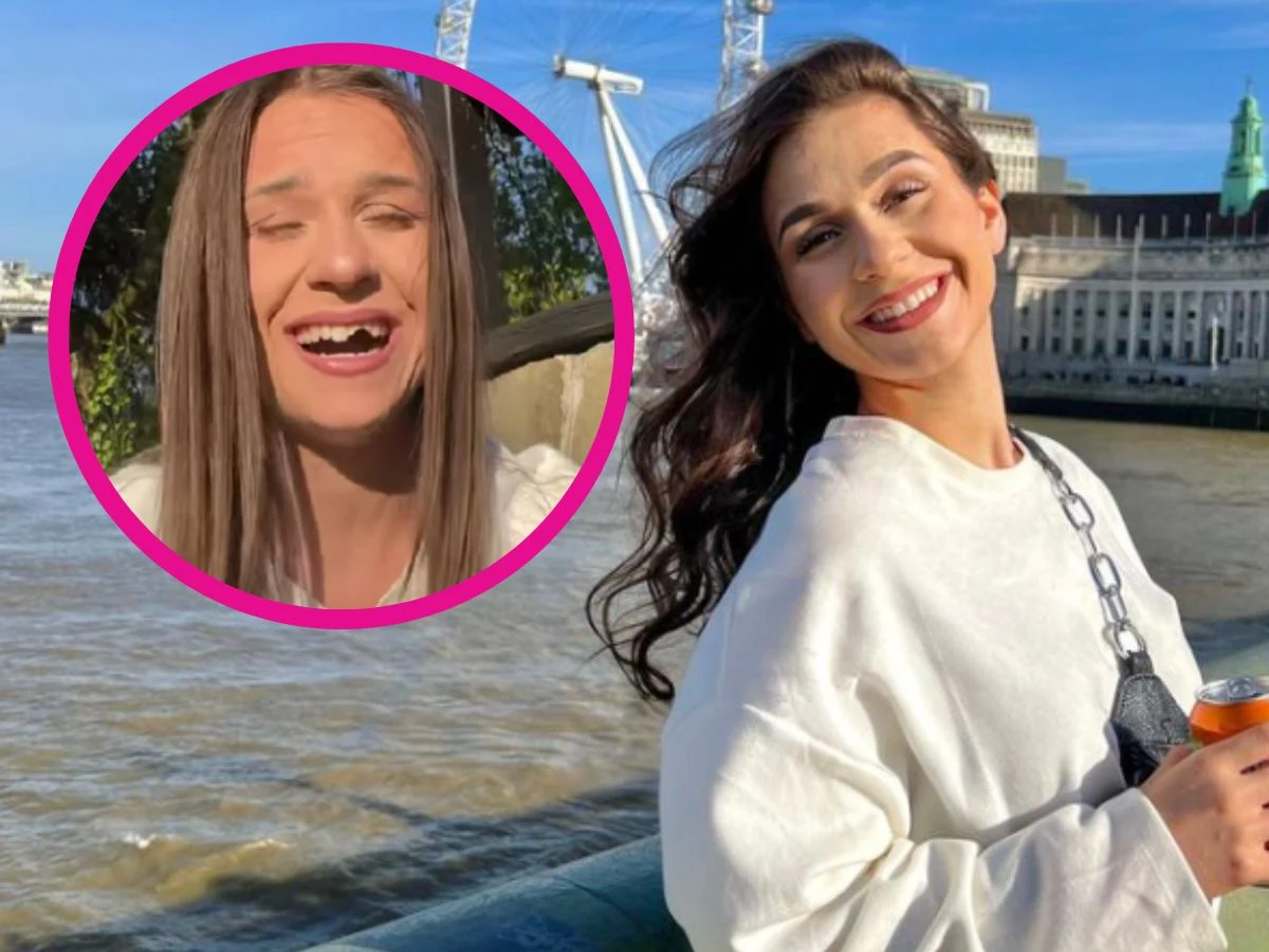 Influencerka Karolina Byrgiel skończyła bez zęba. Jak do tego doszło?
