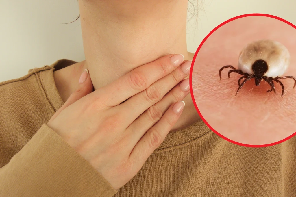 Lekarze uspokajają - połknięcie kleszcza nie jest niebezpiecze