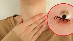 Lekarze uspokajają - połknięcie kleszcza nie jest niebezpiecze