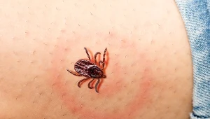 Przebieg zakażenia Candidatus Neoehrlichia mikurensis może być ostry lub przewlekły