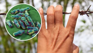 Narażeni są działkowcy i miłośnicy zwierząt. Umiera połowa zakażonych