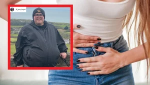 Kobieta przez dziesięć lat szukała przyczyny swojego wyglądu oraz złego samopoczucia. Diagnoza okazała się być szokująca