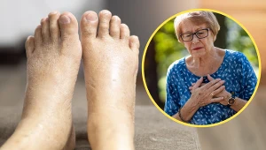 Objawy choroby zobaczysz na paznokciach i ustach. Grożą zawałem serca 