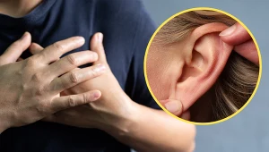 Znak Franka rozwija się pod wpływem przewlekłego i długotrwałego niedotlenienia płatka ucha, na skutek zmian naczyniowych