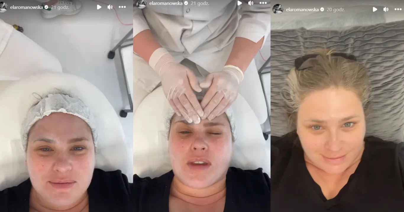 Ela Romansowska podczas zabiegów upiększających /https://www.instagram.com/elaromanowska/