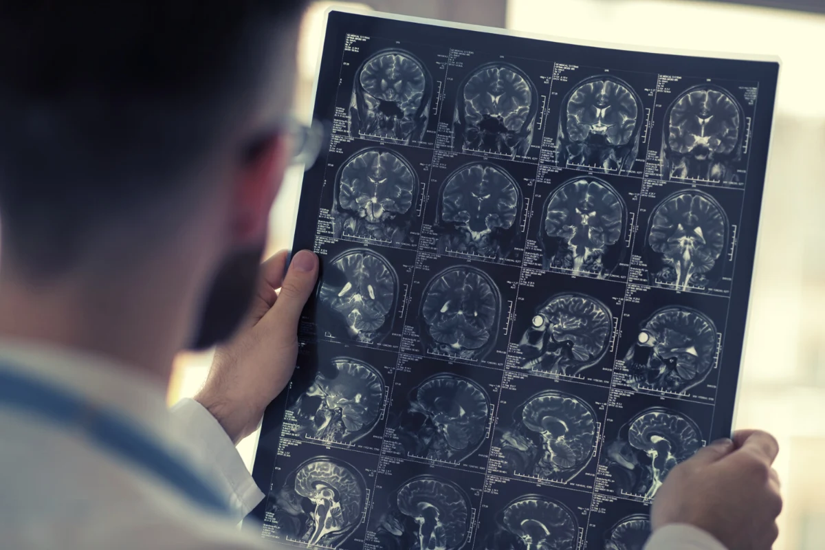 Podczas diagnostyki chorób rzadkich wykonuje się wiele badań, w tym rezonans magnetyczny 