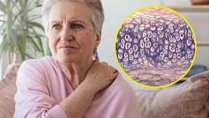 Zawroty głowy i zmęczenie to początek objawów. Tak poznasz niedobór sodu