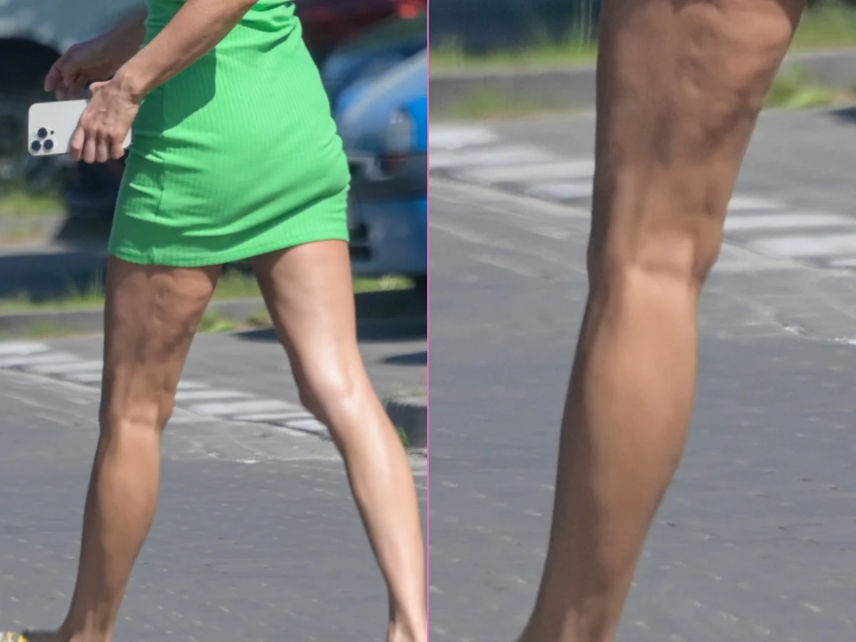 Zwiotczałe nóżki Małgorzaty Rozenek Zwiotczałe nóżki Małgorzaty Rozenek