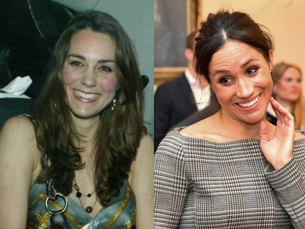 Księżna Kate i Meghan Markle miały operacje plastyczne? Lekarz zabrał głos