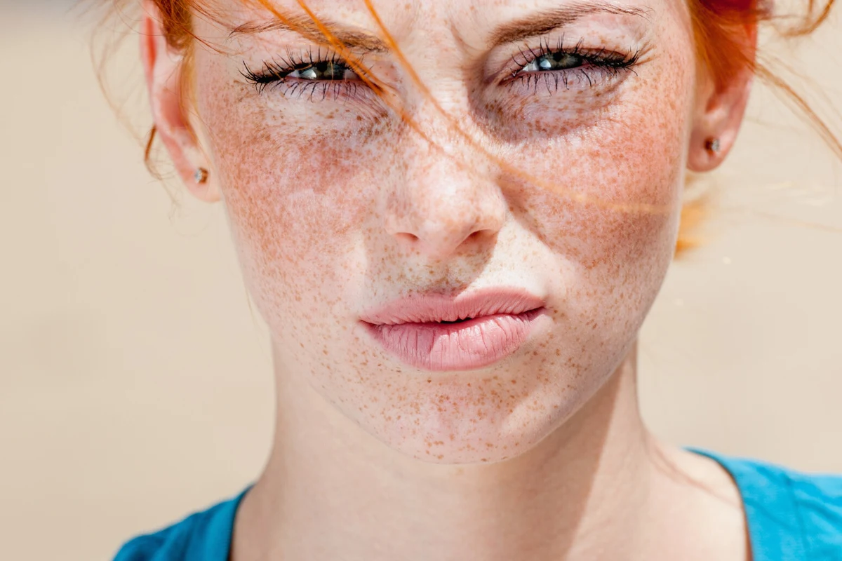 Jeśli chcesz się pozbyć piegów i zrobić to w bezpieczny dla zdrowia sposób, skonsultuj się z dermatologiem