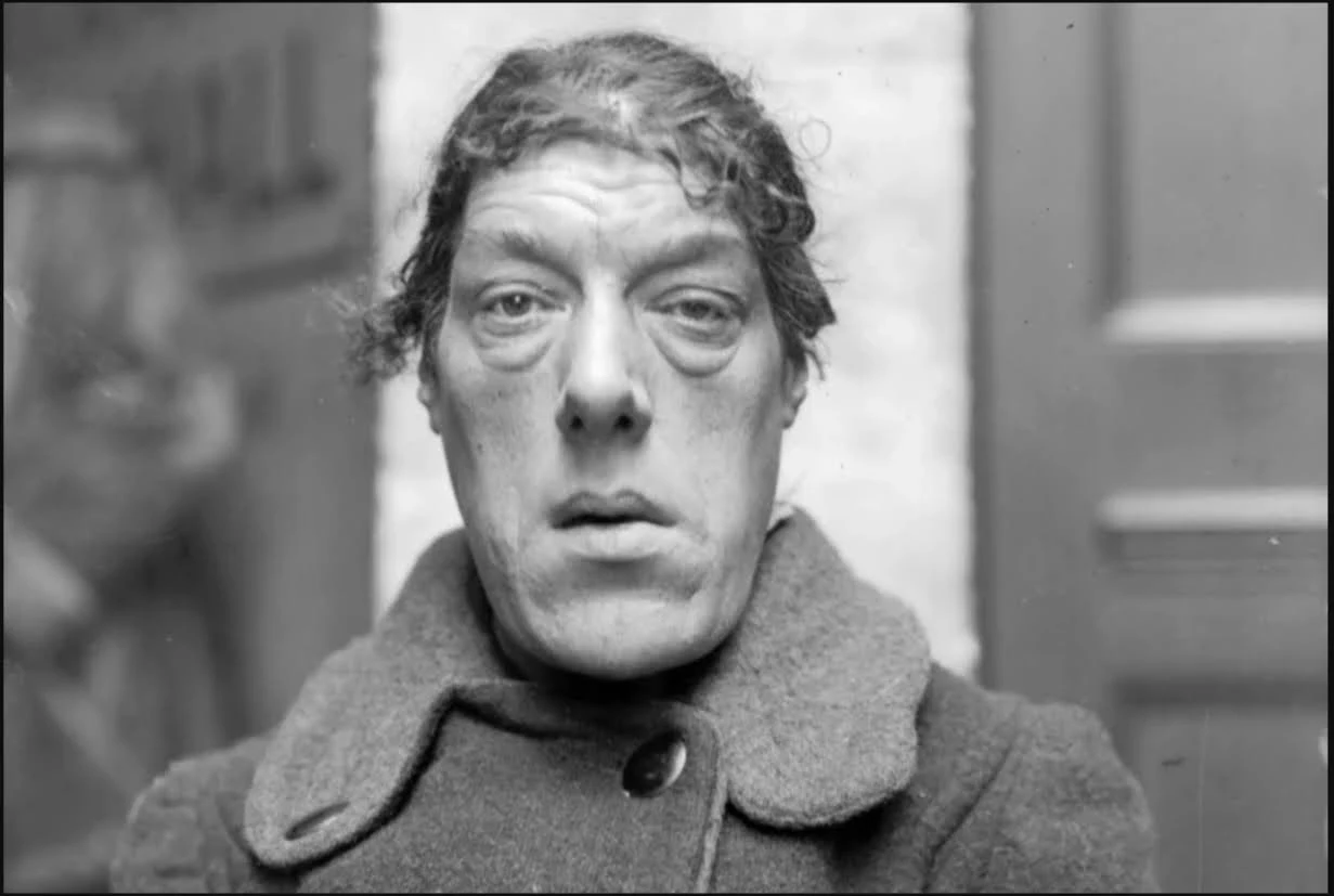 Mary Ann Bevan /A. R. Coster / Stringer /Getty Images 