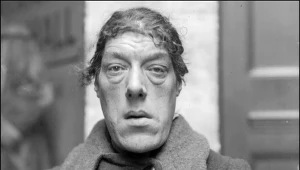 Nazywano ją "najbrzydszą kobietą świata". Choroba zmieniła ją nie do poznania