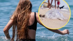 Poparzenie przez meduzę bywa nie tylko bolesne, ale również groźne w skutkach. Wyjaśniamy, jak postępować