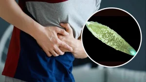 Ten pasożyt latem atakuje częściej. Upośledza wątrobę i rujnuje zdrowie