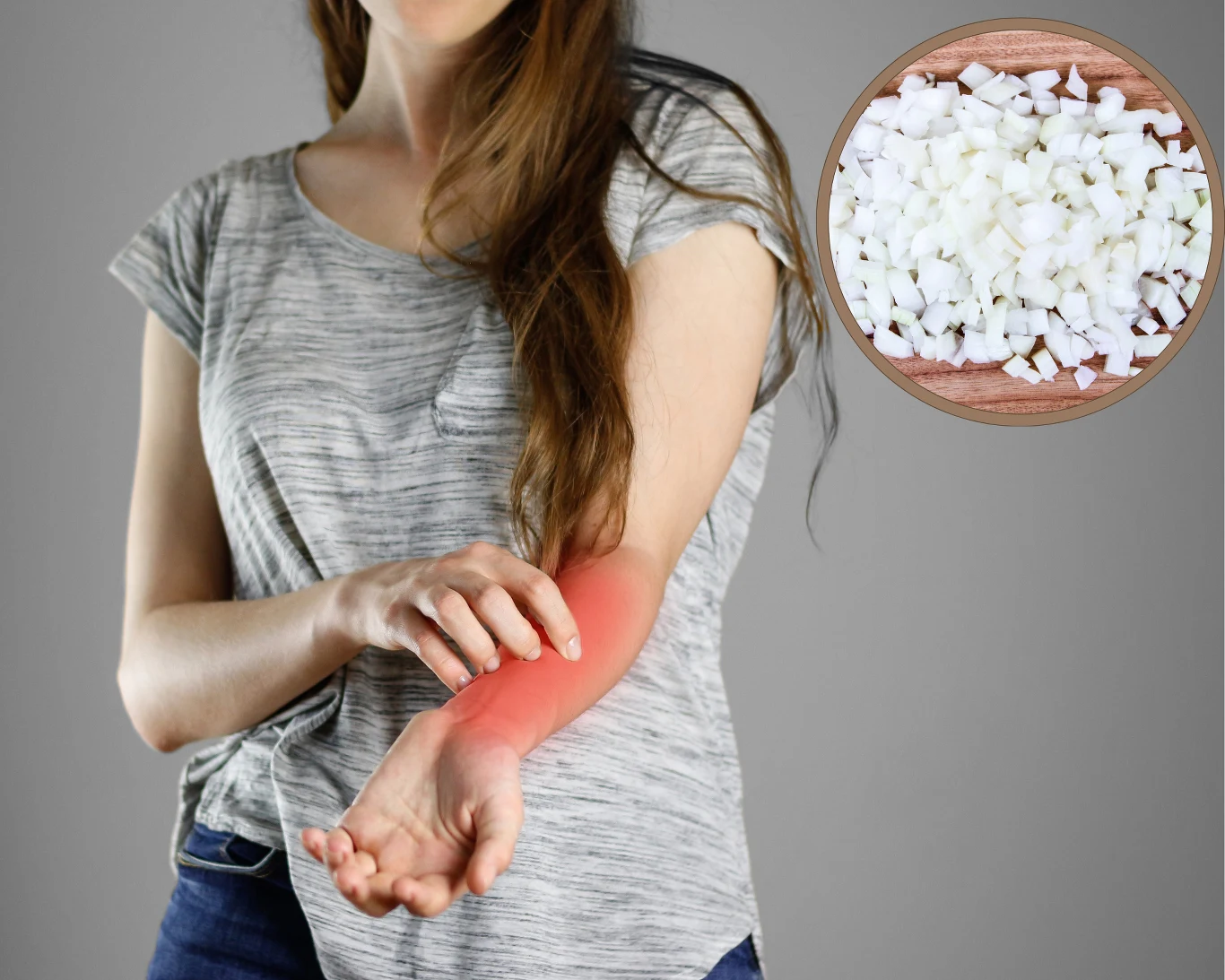 Na oparzonym miejscu warto zrobić okład z cebuli. To stara, sprawdzona metoda Na oparzonym miejscu warto zrobić okład z cebuli. To stara, sprawdzona metoda