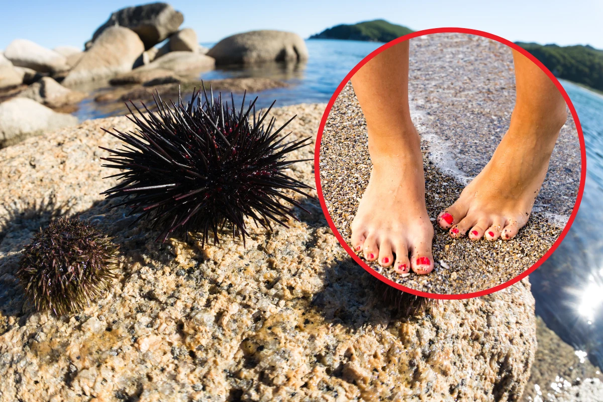 Jeżowce w morskich płyciznach to domena Chorwacji. Jeden nieostrożny ruch i wakacje masz z głowy Jeżowce w morskich płyciznach to domena Chorwacji. Jeden nieostrożny ruch i wakacje masz z głowy