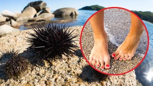 Jeżowce w morskich płyciznach to domena Chorwacji. Jeden nieostrożny ruch i wakacje masz z głowy