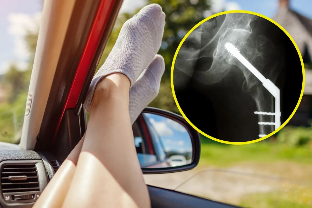 Siła, z jaką wybucha poduszka powietrzna w samochodzie, może doprowadzić do poważnych urazów, jeśli pasażer siedział nieprawidłowo