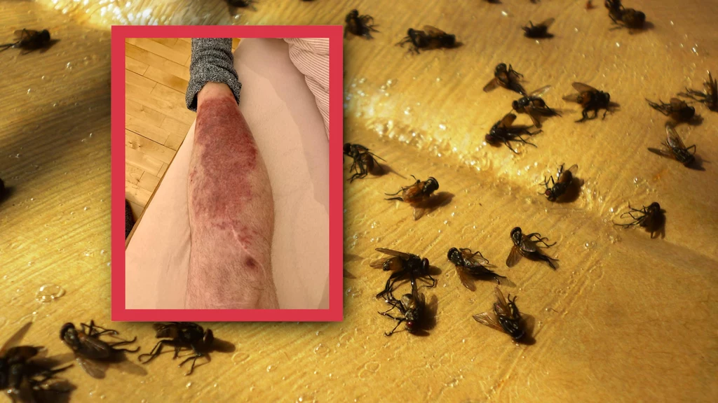 Mieszkańcy wsi pod Wrocławiem skarżą się na inwazję much. Owady mają powodować m.in. ostre bakteryjne zapalenia skóry