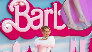 Nowy niebezpieczny trend Barbie. Eksperci alarmują i ostrzegają przed trwałymi urazami