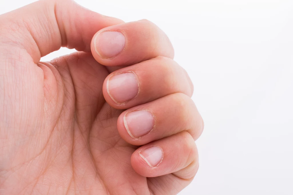 Jakie choroby można odczytać z paznokci? Organizm daje ci znak