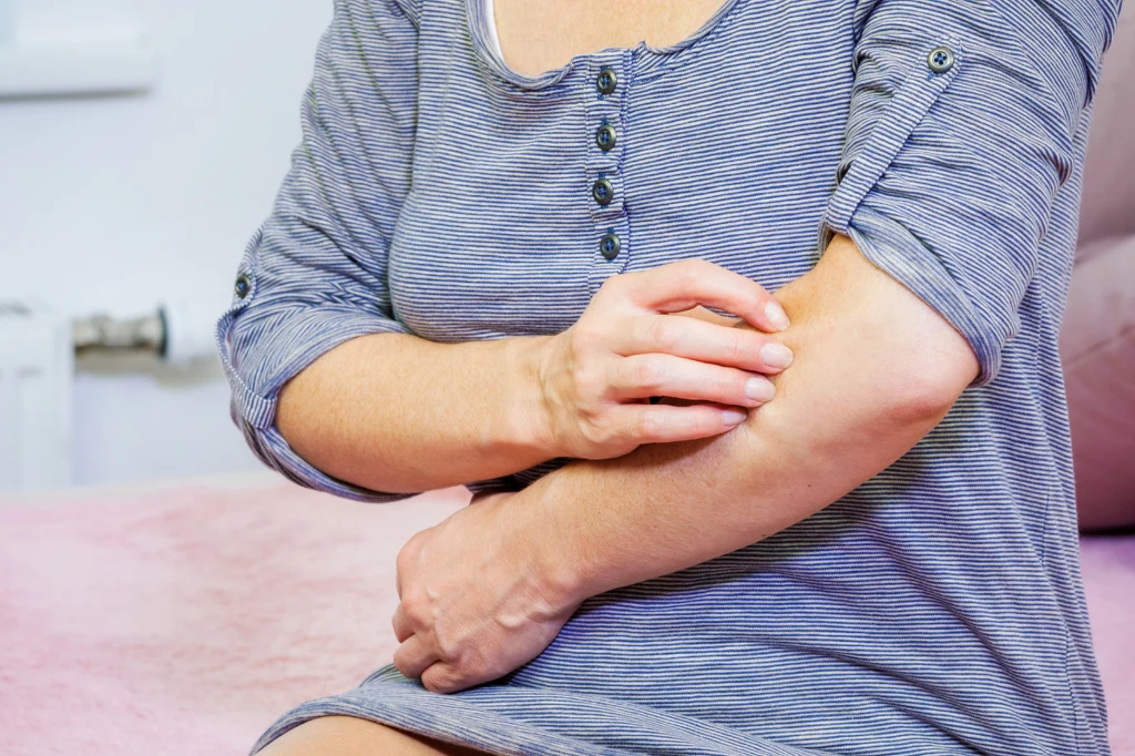 Swędzenie skóry może być objawem wielu chorób - nie tylko dermatologicznych