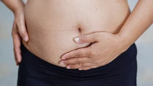 Chcesz rozjaśnić bliznę po cesarce i rozstępy? Unikaj powszechnych błędów i nie zapomnij o pielegnacji