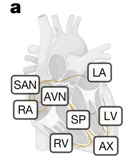 Osiem badanych obszarów serca, w tym węzeł zatokowo-przedsionkowy (SAN) i węzeł przedsionkowo-komorowy (AVN)