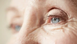 Z zaćmą najczęściej borykają się seniorzy, ale choroba może zostać zdiagnozowana tak naprawdę na każdym etapie życia