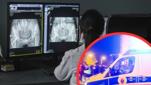 Polacy unikają profilaktyki medycznej. Z własnej woli zbadałaby się mniej niż połowa zapytanych. Zdj. ilustracyjne