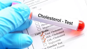 Przełomowy zastrzyk "antycholesterolowy". Statyny do kosza?
