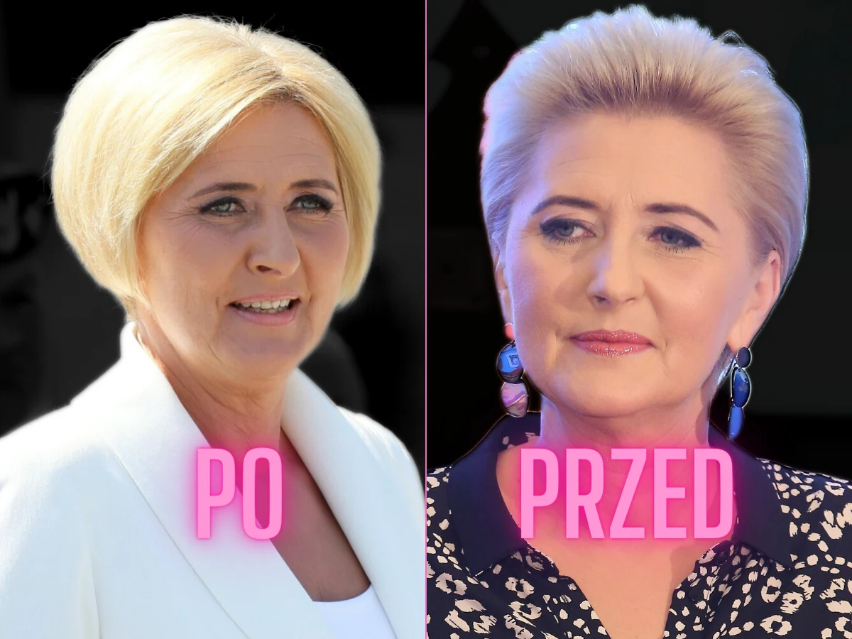 Agata Duda przed i po