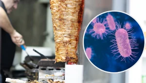 Objawy salmonellozy to nie tylko ból brzucha. Zagrożenie jest śmiertelne