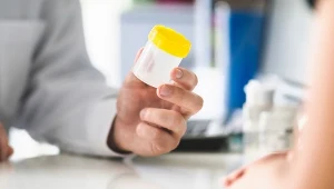 W moczu zdrowego człowieka glukoza naturalnie nie występuje