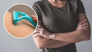 Nadmierne owłosienie na przedramionach i ramionach u kobiet może być wynikiem choroby