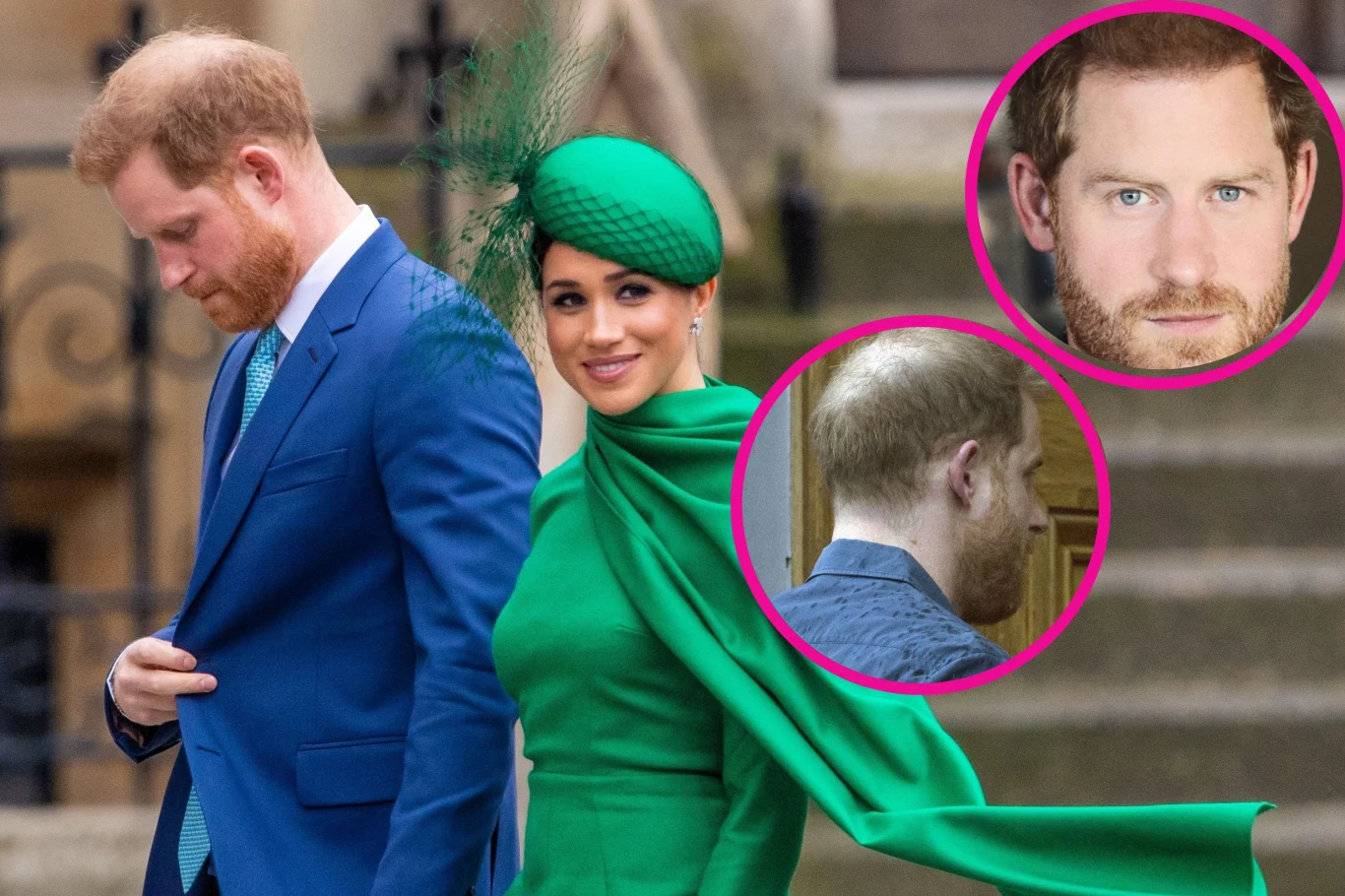 Harry ma genetyczny problem Harry ma genetyczny problem