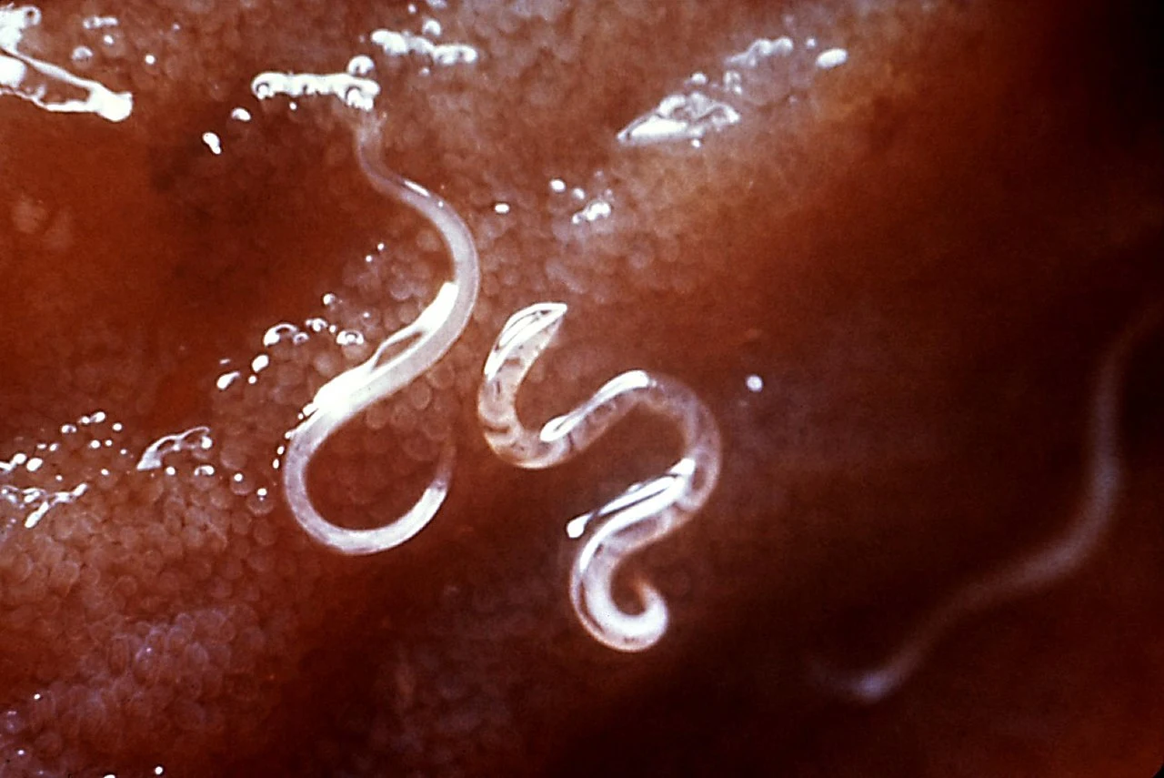 Tęgoryjce Ancylostoma caninum przyczepione do błony śluzowej jelita Tęgoryjce Ancylostoma caninum przyczepione do błony śluzowej jelita