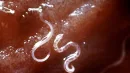 Tęgoryjce Ancylostoma caninum przyczepione do błony śluzowej jelita (zdj. ilustracyjne)