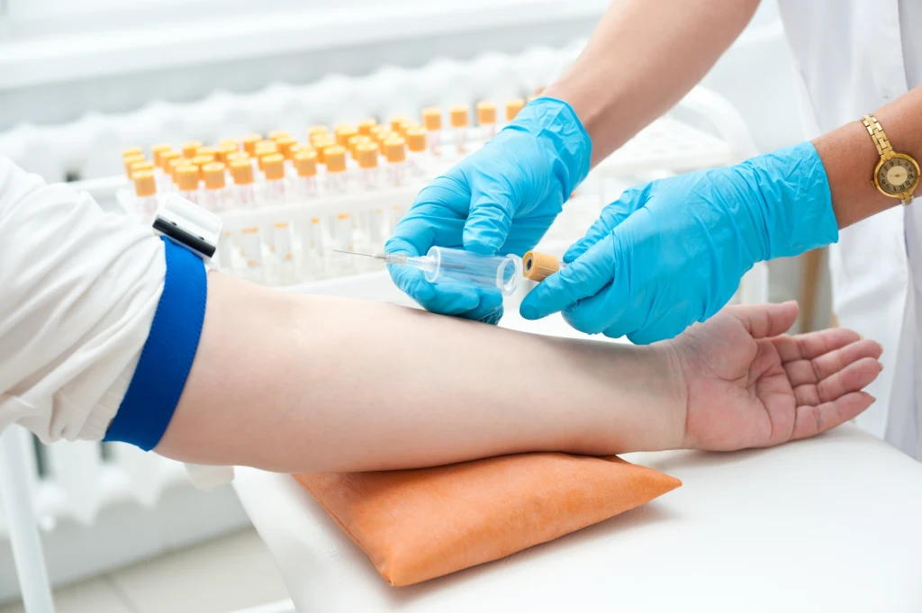 Na 30 minut przed pobraniem krwi zaleca się wypicie szklanki wody. Dlaczego? O czym trzeba pamiętać? Odpowiadamy Na 30 minut przed pobraniem krwi zaleca się wypicie szklanki wody. Dlaczego? O czym trzeba pamiętać? Odpowiadamy